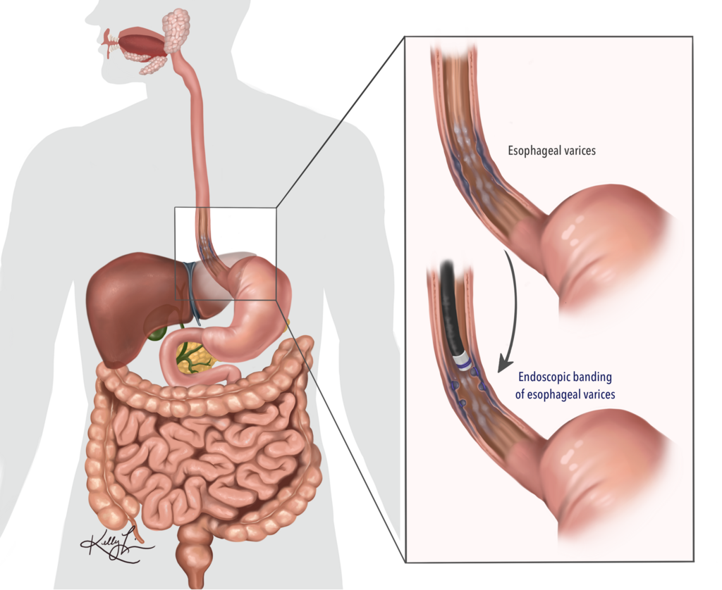 Lesson image