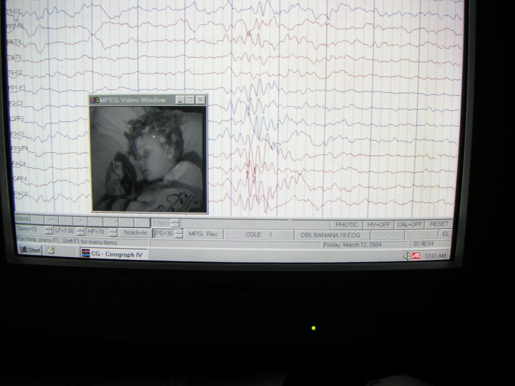Lesson image