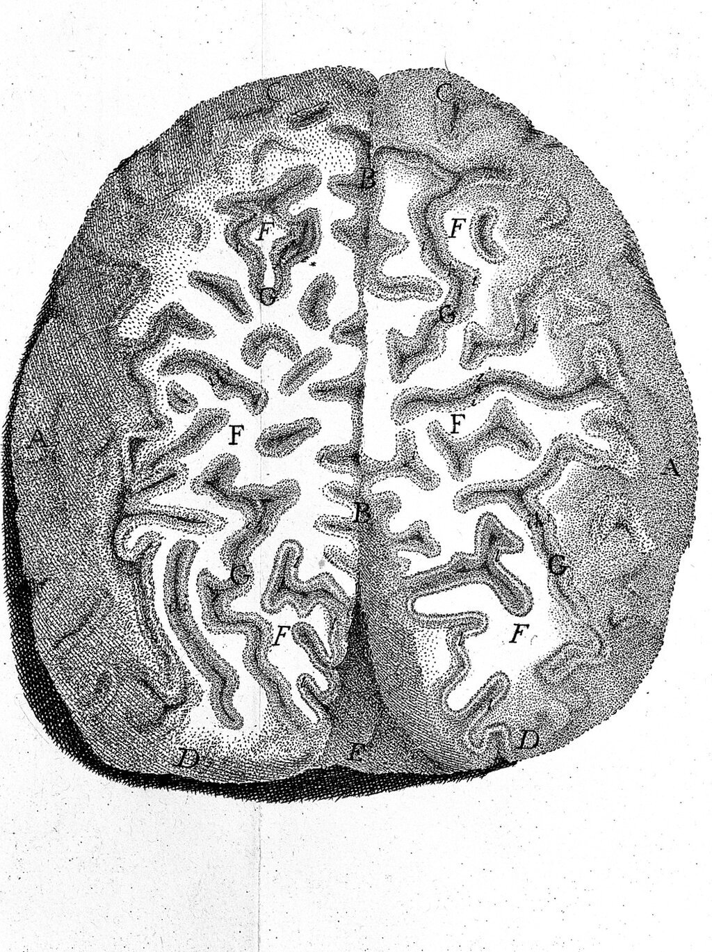 Lesson image