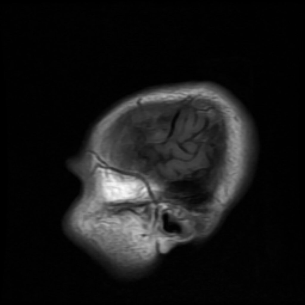 Lesson image