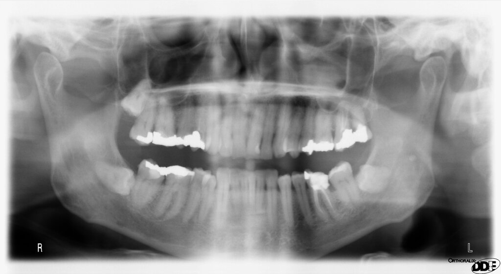 Lesson image