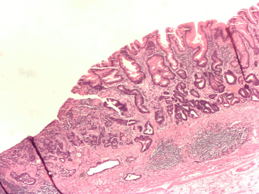 Lesson image