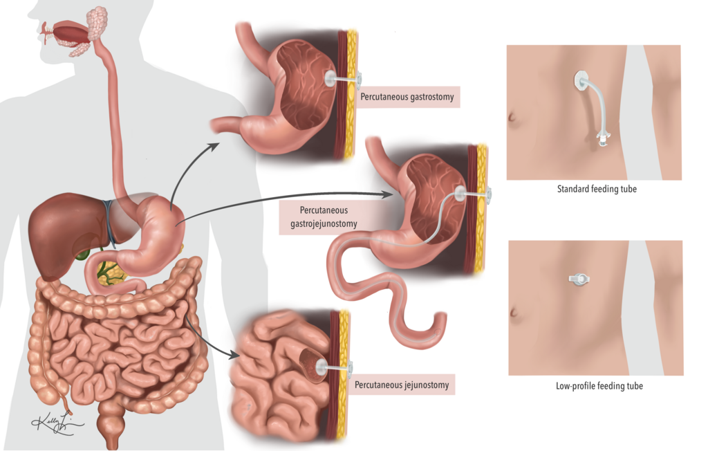 Lesson image