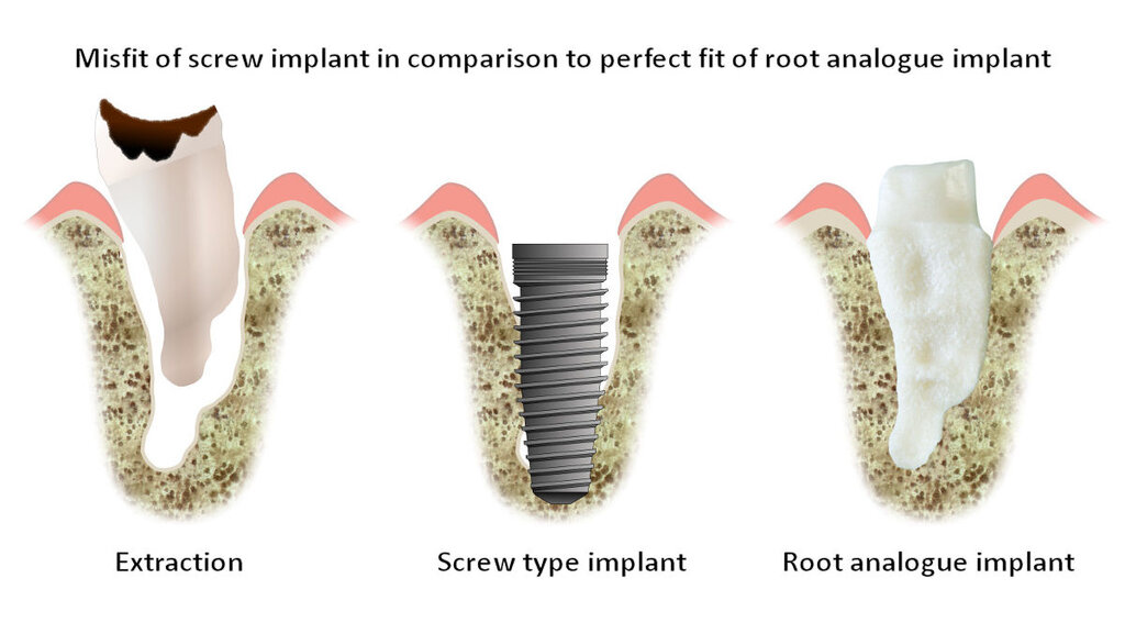 Lesson image
