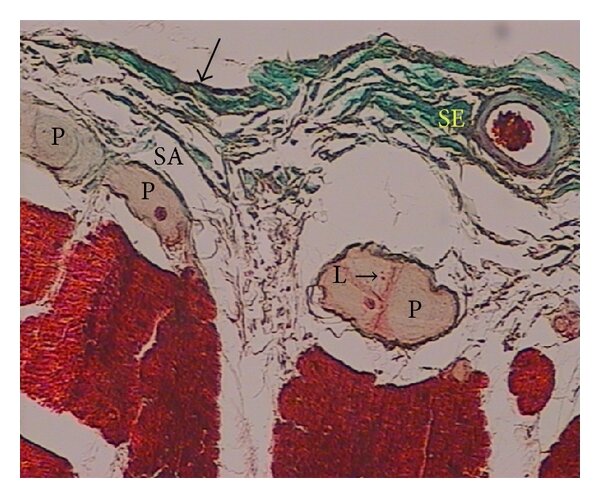 Lesson image