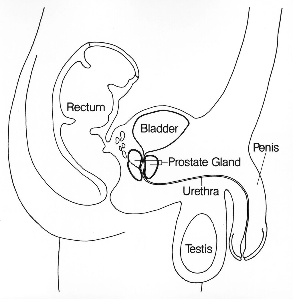 Lesson image