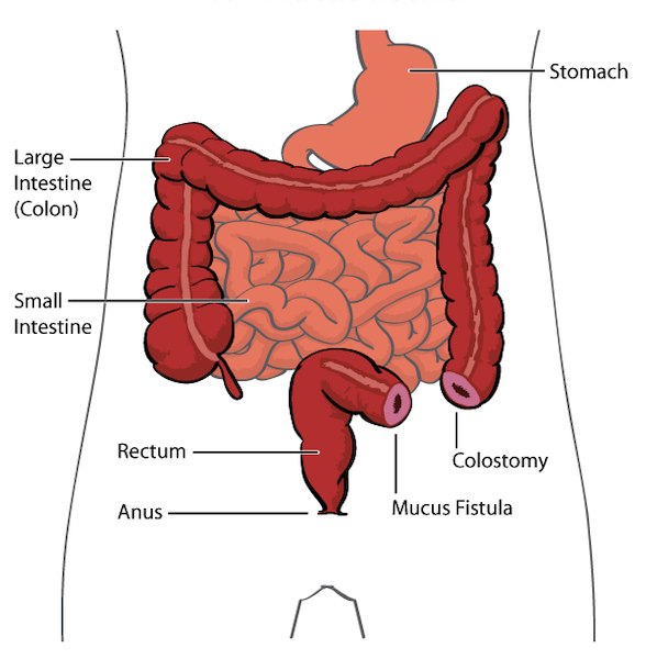 Lesson image